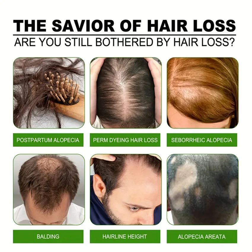 i Bealee - Biotin Hair Growth Essential Oil - Image 5