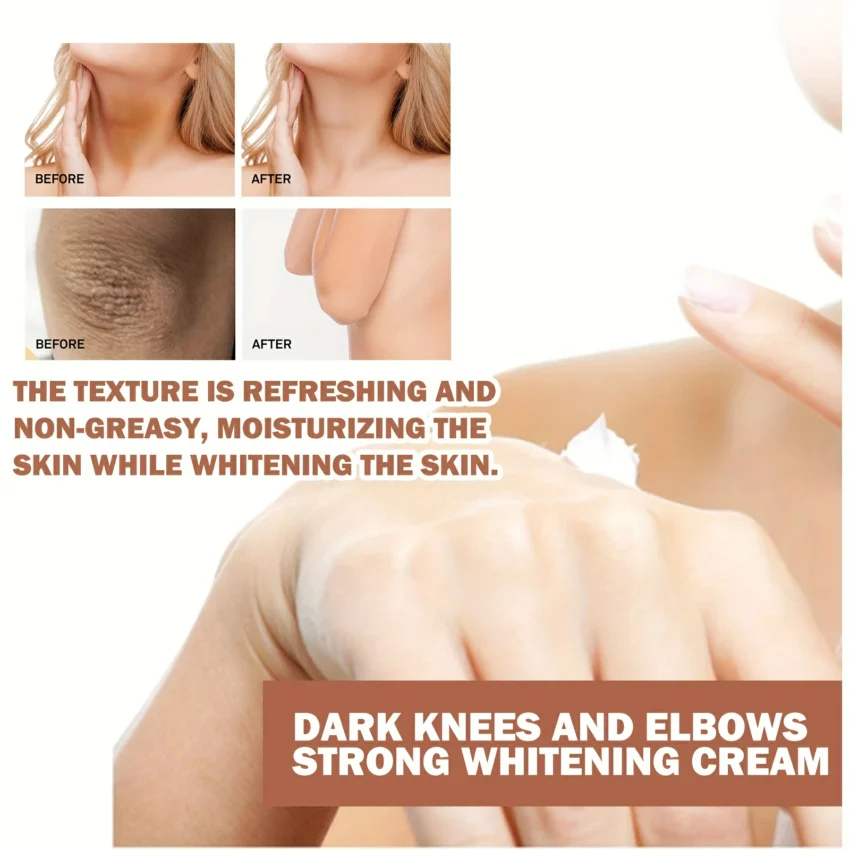 EELHOE - Dark Knees And Elbows Cream - Image 7