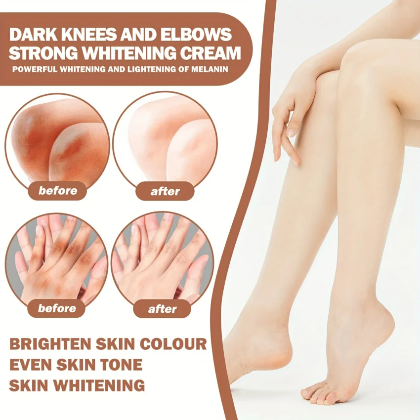 EELHOE - Dark Knees And Elbows Cream - Image 2